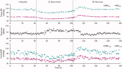 Figure 3. Beat-to-beat measures during the entire course of experiment on a particular subject (#4), indicating the dynamic changes (time synchronized) incurred in the finger DBP and SBP (top row), heart rate (middle row) and carotid DBP and SBP in response to the intervention.