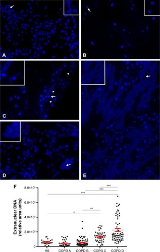 Figure 6 DAPI staining of LR-white semithin sections of induced sputum plugs.