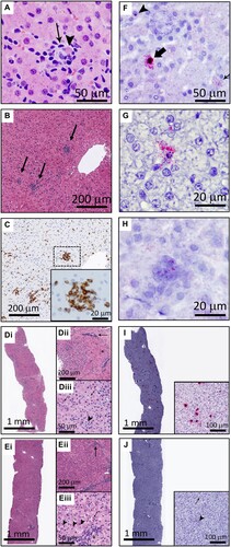 Figure 4. EqPV-H infects hepatocytes and results in hepatocellular necrosis with lymphocytic infiltrates. (A) An individual, necrotic hepatocyte (arrowhead) surrounded by small lymphocytes (arrow). Horse I, HE. (B) Random multifocal clusters of lymphocytes in the hepatic parenchyma (arrows). Horse J, HE. (C) Cells within the clusters of lymphocytes are CD3 positive. Horse J, CD3 IHC. (D) Horse A had the most severe biochemical and clinical hepatitis, which corresponded with the most severe liver pathology. At the beginning of hepatitis (week 7), there was marked increase in cellularity throughout the parenchyma (Di). Pathology was minimal in periportal regions (asterisk, Dii) and portal tracts contained few inflammatory cells (arrow, Dii). Increased numbers of individual necrotic hepatocytes (arrows, Diii), and clusters of lymphocytes, neutrophils, and macrophages surrounding necrotic hepatocytes (arrowhead, Diii), were found throughout zones 2 and 3 of lobules. (E) Seven days later, Horse A’s parenchymal cellularity was already reduced (Ei, Eii). Inflammatory cells and individual necrotic hepatocytes were reduced overall, although portal tracts still contained increased numbers of mixed inflammatory cells (arrow, Eii). Increased numbers of hepatocytes with mitotic figures (arrowheads, Eiii) and fewer individual necrotic cells (arrow, Eiii) were found throughout the parenchyma, compared to the week 7 biopsy (D). Inflammatory cells in portal tracts narrowly breached the limiting plate (asterisk, Eiii). (F) Three hepatocytes are shown demonstrating the range of in situ hybridization intensity with punctate nuclear (arrowhead), cytoplasmic (thin arrow), and combined nuclear and cytoplasmic (broad arrow) hybridization. Horse J, EqPV-H ISH, antisense probe. (G) An individual necrotic cell with nuclear karyorrhexis and EqPV-H hybridization within the cytoplasm and extending into the surrounding parenchyma. Horse B, EqPV-H ISH, antisense probe. (H) A focal aggregate of cells in the parenchyma with positive hybridization. Horse I, EqPV-H ISH, sense probe. (I) The biopsy with the most severe pathology had large numbers of hepatocytes with mild to strong positive nuclear and cytoplasmic hybridization (Horse A week 7, same sample as D, EqPV-H ISH, antisense probe). (J) One week later, EqPV-H hybridization was rare (Horse A week 8, same sample as E, EqPV-H ISH, antisense probe) with only mild nuclear (arrowhead) and/or cytoplasmic (arrow) hybridization.