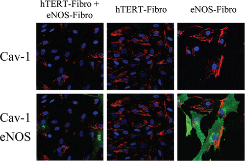 Figure 16 Paracrine NO production downregulates Cav-1 in adjacent normal fibroblasts: Evidence for a field effect. NO-overproduction downregulates Cav-1 expression. hTERT-fibroblasts stably expressing eNOS (eNOS-fibro) were co-cultured with control hTERT-fibroblasts for 5 days. Homotypic cultures of both types of fibroblasts were also established in parallel. Then, cells were immunostained with anti-Cav-1 (red) and eNOS (green) antibodies. DAPI was used to stain nuclei (blue). Upper panels show only the red channel to appreciate Cav-1 staining, while the lower panels show the merged images. Note that co-culture of eNOS-fibroblasts and hTERT-fibroblasts (originally plated in a 1:1 cell ratio) greatly downregulates Cav-1 expression in all cells, suggesting a “field effect” secondary to NO over-production. Importantly, images were acquired using identical exposure settings. Original magnification, 40x.