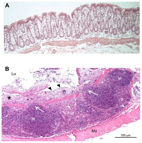 Figure 3 (A) Histologic appearance of the normal colonic mucosa of healthy control rat (intact crypts); (B) distal colon mucosa of rat with dextran sodium sulfate (DSS) colitis (rat no DSS-4) showing inflammatory infiltration and loss of mucosal architecture (see asterisk).