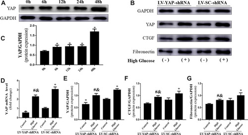 Figure 5 YAP expression and fibrosis levels in CFs in vitro (n=5). (A) Western blot analysis of YAP protein expression stimulated by high glucose (25 mM) at different time points. (B) Western blot analysis of YAP, CTGF and fibronectin protein expression in CFs transfected with YAP-shRNA or scramble-shRNA. (C) Quantitative analysis of YAP protein expression shown in (A). (D) YAP mRNA expression in CFs transfected with YAP-shRNA or Scramble-shRNA. (E–G) Quantitative analysis of YAP, CTGF and fibronectin protein expression shown in (B). *P<0.05 versus the control group transfected with Scramble-shRNA; #P<0.05 versus the high glucose group transfected with Scramble-shRNA; &P<0.05 versus the control group transfected with YAP-shRNA.