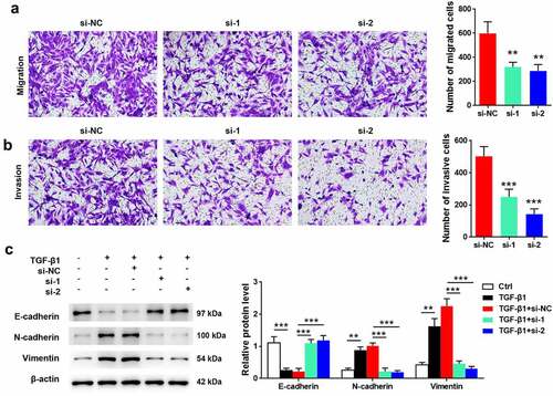 Figure 3. Effects of FGFR2 on ESC migration, invasion, and TGF-β1-induced EMT. FGFR2 siRNAs (si-1 and si-2) or the negative control (si-NC) were transfected into ESCs. Transwell assays were performed for detecting (a) cell migration and (b) invasion. (c) Cells were treated with 10 ng/ml TGF-β1 for 24 h. Expression of EMT-related proteins was detected by western blotting. **p < 0.01, ***p < 0.01 vs. si-NC group or the indicated group.