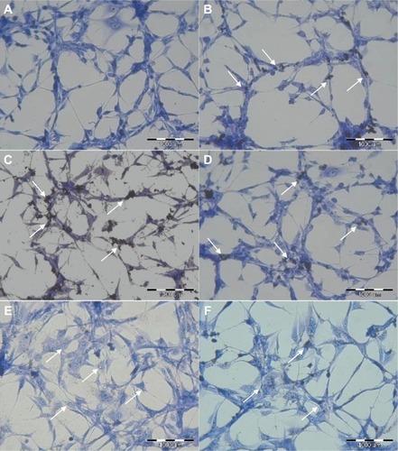 Figure 2 Evaluation of U87 cell morphology using May-Grünwald-Giemsa staining. Images show control cells (A) and cells incubated with graphene oxide (B), reduced graphene oxide (C), pristine graphene (D), ultradispersed detonation diamond (E), and graphite (F). Arrows point to graphene (B–D), ultradispersed detonation diamond (E), and graphite (F).