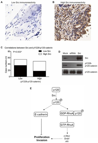Figure 5 Src is the upstream kinase catalyzing Y228 phosphorylation of p120-catenin. (A) Representative immunohistochemical result of low Src expression in colon adenocarcinoma (IHC score=1). (B) Representative immunohistochemical result of high Src expression in colon adenocarcinoma (IHC score=4). (C) Higher Src expression is correlated with higher pY228-p120-catenin level in clinical CAC tissues (P=0.003). (D) Overexpression of Src induced hyperphosphorylation of Y228 on p120-catenin, while silencing Src by siRNA resulted in a lower pY228-p120-catenin level compared to the control group. (E) A schematic model shows our hypothesis that p120-catenin exhibits anticancer functions via E-cadherin and RhoA signaling pathways.