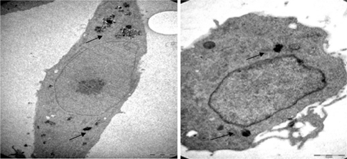 Figure 5 Transmission electron micrographs of a IH/3T3 cell. A) (6000×) treated with 4.5 μg/mL Ma-Fol-modified magnetic nanoparticles for 24 hours. B) (16,500×) treated with 4.5 μg/mL folic acid-modified magnetic nanoparticles for 48 hours.Abbreviation: Ma-Fol, methacrylamido-folic acid.