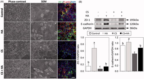 Figure 3. Morphology and cell-cell boundaries of RECs treated with/without HA (2 mg/ml) and CS (0.1 mg/ml) at day 21 after ALI using light microscope (A, left panels) and scanning electron micrographs (A, middle panel, magnification 1500×). Immunofluorescent confocal images of ZO-1 (A, right panels, 400×). Cellular cytoskeletal shape (F-actin) is outlined by rhodamine-phalloidin. Nuclei are labeled with DAPI. B: Western blot analyses of tight junctions (ZO-1 and E-cadherin) in RECs (top). Densitometric analyses (bottom). Scale bar = 20 μm. Different letters indicate significant differences, while the same letter indicates no significant differences (n = 5, p < .05).