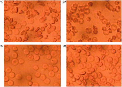 Figure 3. Example of RBC aggregation – (a) and (c) in saline. The same sample (a) of RBC in the presence of lyophilized plasma (b) and same sample of RBC (c) in the presence of lyophilized platelets (d). The picture was made after 5 minutes of interaction with either plasma or platelets, classical rouleaux formation occurred. These samples were viewed under standard light microscopy conditions.