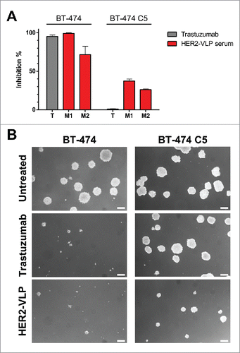 Figure 6. Antibodies elicited by the HER2-VLP vaccine inhibit 3D growth of human breast cancer cells. HER2-positive BT-474 cells and the trastuzumab-resistant clone BT-474 C5 were seeded in soft agar containing either trastuzumab (10 μg/ml) or sera (diluted 1:100) from two Delta16 mice (labelled as M1 and M2), vaccinated with HER2-VLP. The concentration of anti-HER2 Abs in mouse sera, as determined by ELISA, was comparable to that of trastuzumab (9.7–11.5 μg/ml). (A) Inhibition of agar colony number, counted 18 days after seeding. Each bar represents the mean (and SEM) inhibition of colony number in two independent plates. Inhibition by trastuzumab or anti-HER2 sera was calculated in reference to wells containing medium alone and normal mouse serum, respectively. (B) Dark-field micrographs of colonies in agar. Pictures labelled ‘HER2-VLP’ correspond to serum M1 in panel A. White bar corresponds to 200 μm.