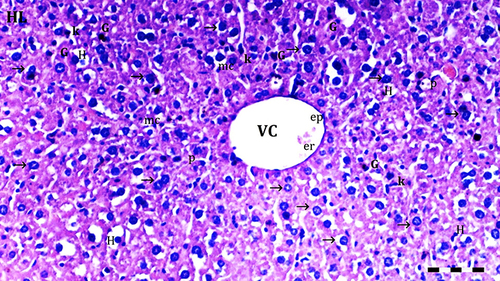Figure 2 Representative light microscopy of hepatic tissue from the D group. Scale bar 50 µm, H&Ex100.