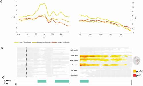 Figure 4. Naming from definition task. (a) Exemplar condition-averaged Event-Related Potential waveform (Oz) for the three groups plotted in microvolts in function of time. (b) Periods of significant differences (in red p < .01, in yellow p < .05, in white p ≥ .05) in amplitudes between the three groups on each electrode and time-frame for the stimulus-locked and response-locked Event-Related Potentials. Visualization of electrode sites yielding significant difference are highlighted on the scalp exemplar. (c) Periods of significant differences in the topographic ANOVA analysis (p < .01) in turquoise.