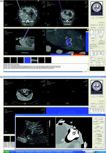 Figure 4. User interface of the Navigator system. (a) A display showing the axial, sagittal, coronal, and tool-tip views. (b) Integration of the tracked ultrasound. An ultrasound image and re-sliced CT image from the same plane are reconstructed and compared. [Color version available online.]