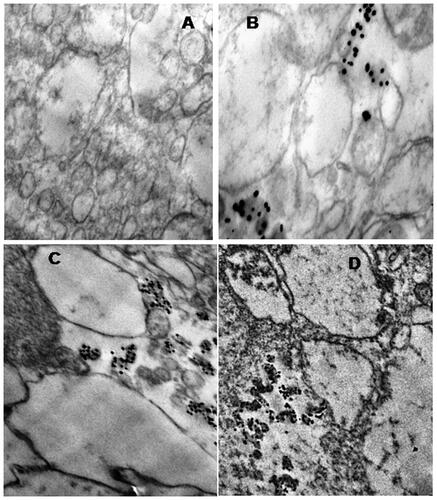 Figure 10. Macrophage uptake of AGAunp in TEM observed at different time intervals. (A) Macrophages with no AGAunp exposure, (B) after 15 min of AGAunp exposure, (C) after 1 h of AGAunp exposure, (D) after 2 h of AGAunp exposure.