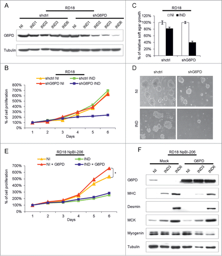 Figure 7. G6PD downregulation interferes with the transformed phenotype of ERMS cells but its overexpression does not affect miR-206-mediated ERMS cells differentiation. (A) Western Blot analysis of G6PD in RD18 cells conditionally expressing a control (shctrl) or a G6PD-directed (shG6PD) shRNA, treated or not with doxycycline for the indicated days (shRNA not induced, NI; shRNA induced, IND). (B) MTT analysis of the cells indicated in (A). Cells were analyzed for the indicated days in absence of doxycycline (shRNA not induced, NI) or after doxycycline administration (shRNA induced, IND). The number of cells at day 0 was set at 100%. (C) Quantification of soft agar growth assays of the cells indicated in (A). The number of colonies obtained from cells maintained in absence of doxycycline (shRNA not induced, NI) was set at 100%. (D) Representative images of the experiment indicated in (C). (E) MTT analysis of RD18 NpBI-206 cells overexpressing or not G6PD lacking the 3’UTR. Cells were analyzed for the indicated days in the absence of doxycycline (miR-206 not induced, NI) or after doxycycline administration (miR-206 induced, IND). The number of cells at day 0 was set at 100%. Student's t-test was used to evaluate statistical significance: *P <0.05. (F) Western blot analysis of the indicated proteins in the cells indicated in (E), treated or not with doxycycline for the indicated days (miR-206 not induced, NI; miR-206 induced, IND).