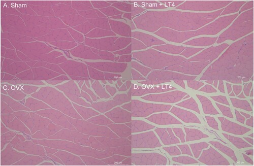 Figure 3. The representative hematoxylin-eosin staining of coronary section of soleus muscle in light microscope images of hematoxylin-eosin stained section of soleus muscle. Sham operated (Sham) only rats (A) showed most intact and dense morphology of the muscle (A). Sham with LT4 treatment (B) or OVX OVX without LT4 treatment (C) showed disorganized and muscle fibers and widening change of the interstitium compared with Sham group (A). OVX + LT4 rats (D) showed most significant decreased muscle volume, sparsely distributed muscle fibers and widened interstitium of soleus muscle.
