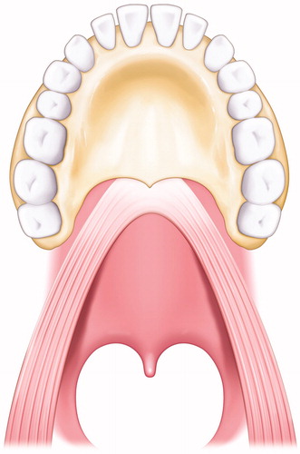 Figure 1. Illustration of the state of the LVPM. The LVPM continues from side to side, and the anterior portion is attached to the posterior border of the hard palate.