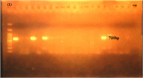 Figure 4 The 700-bp PCR amplification of blaNDM gene among P. aeruginosa isolates. First lane, DNA ladder, 100-bp DNA size marker; −ve, negative control.