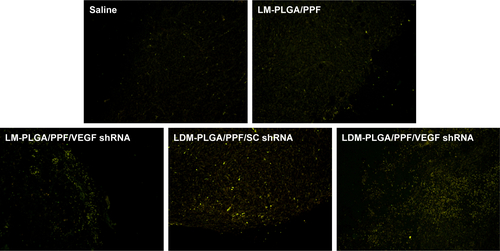 Figure S8 TUNEL staining of the tumors with different treatments.Note: TUNEL-positive cells (apoptotic cells) exhibited yellow-green fluorescence.Abbreviations: PLGA, poly(d,l-lactic-co-glycolic acid); PPF, PEI-PEG-FA; PEI-PEG-FA, polyethyleneimine premodified with polyethylene glycol-folic acid; SC shRNA, scrambled small hairpin RNA; TUNEL, terminal deoxynucleotidyl transferase dUTP nick-end labeling; VEGF, vascular endothelial growth factor.