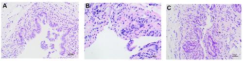 Figure 2 Hematoxylin and eosin staining of rabbit SO tissue (400×, 20 um), (A) Normal group, (B) Model group, (C) Treatment group. The arrow (←) refers to mucosal epithelial cells, the (*) refers to inflammatory cells infiltration.