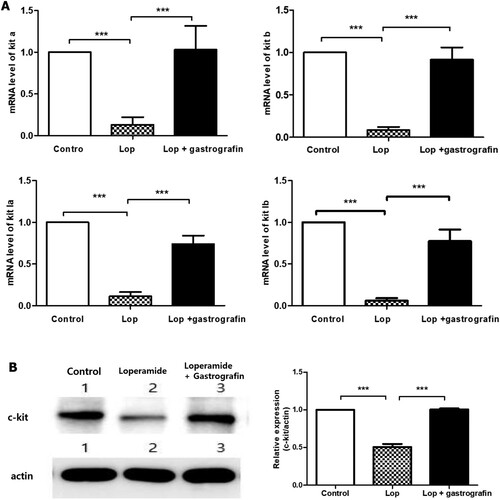 Figure 4. Effect of gastrografin on (A) the mRNA expression of kit genes and (B) C-kit protein expression in zebrafish larvae with loperamide-induced constipation. Lop, loperamide; la, ligand a; lb, ligand b (***P < 0.001).