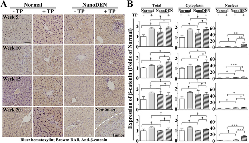 Figure 3 Nuclear expression of β-catenin was significantly elevated after TP injection in nanoDEN-treated mice.