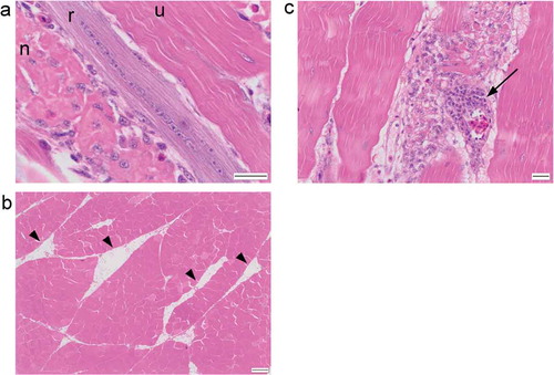 Figure 2. (a) Longitudinal section of breast muscle showing an unaffected myofibre (u), a necrotic myofibre (n) and a regenerating myofibre (r). (b) Adipocyte “cords” (arrowheads) present within the breast muscle. (c) H&E stained section of breast muscle with prominent perivascular cuffing (arrow). Scale bar is 20 μm in (a) and (c) and 200 μm in (b).