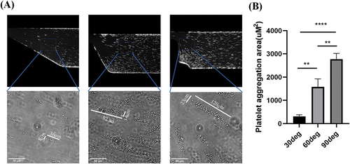 Figure 4. Morphological study of platelet aggregation. (A) Platelet aggregation downstream of different stenosis models. (B) Statistical analysis of aggregate area. The scale bar is in the lower left corner of the figure. P < .05 means the difference is significant, ** stands for P < .005, **** stands for P < .00005. The surface of the microchannel was covered with type I collagen fibers to provide the thrombus surface needed for platelet aggregation.