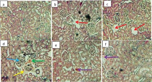 Figure 4. Photomicrographs of the kidney sections of rats exposed to gasoline fumes. H&E stain 200X. (a) Control showing normal cytoarchitecture of renal glomerular capillaries, glomerular space, proximal convoluted tubule and distal convoluted tubules. (b) Exposed to gasoline fumes for 1 h showing mild distal convoluted tubule with large lumen (red arrow). (c) Exposed to gasoline fumes for 3 h showing mild distal convoluted tubule with large lumen (red arrow). (d) Exposed to gasoline fumes for 5 h showing degenerated glomerular capillaries with enlarged space (black arrow), intertubular blood vessel dilation (blue arrow), haemolysed blood vessel (green arrow) and pyknotic nuclei as well as, congestion of interstitial cell and infiltration of mononuclear cell around the glomerular capillaries (yellow arrow). (e) Exposed to gasoline fumes for 7 h showing disseminated congestion of vessels (purple arrow). (f) Exposed to gasoline fumes for 9 h showing disseminated congestion of vessels (purple arrow). (See colour figure online).