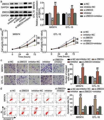 Figure 6. miR-1298-5p plays a role in the proliferation, invasion and apoptosis of GC cells by negatively regulating ZBED3 level (a)Relative protein expression of ZBED3 was determined in MKN74 and GTL-16 cells transfected with si-ZBED3 or miR-1298-5p inhibitor by Western blot. (b) The cell viability was measured in MKN74 and GTL-16 cells transfected with si-ZBED3 or miR-1298-5p inhibitor by CCK-8 assay. (c) The cell invasion ability was determined by transwell assay after knockdown of ZBED3 or miR-1298-5p in MKN74 and GTL-16 cells. (d) The cell apoptosis rate was detected in MKN74 and GTL-16 cells after transfection with ZBED3 siRNA or miR-1298-5p inhibitor plasmids by flow cytometry assay. **P < 0.001 compared to si-NC; ^^P < 0.001 compared to inhibitor-NC; ##P < 0.001 compared to si-ZBED3+ inhibitor.
