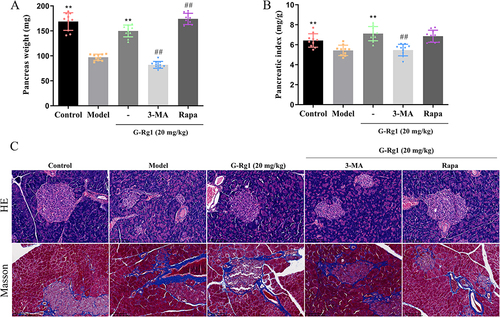 Figure 3 Effect of G-Rg1 on histopathology changes of pancreas in STZ-induced diabetic mice. (A) Pancreatic weight and (B) Pancreatic index. (C) The pathological changes of the pancreas were assessed by H&E and Masson staining (Magnification, ×200). **P<0.01, compared with the model group; ##P<0.01, compared with the G-Rg1 (20 mg/kg) group.