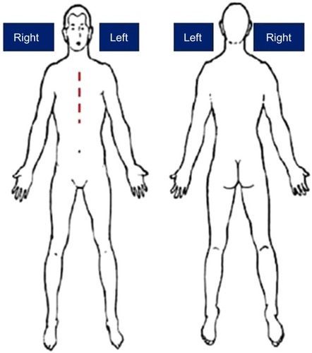 Figure 5 The absence of a precise location of pain.