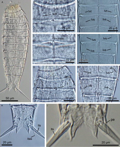 Figure 6. Light micrographs showing overviews and details of trunk morphology in Echinoderes reicherti sp. nov. A–H. Female, holotype (ZMUC-KIN-937). I. Male, paratype (ZMUC-KIN-943). (A) Ventral overview, anterior faces up; (B) Segments 2 and 3, dorsal view; (C) Segments 4 and 5, dorsal view; (D) Segments 1 to 3, ventral view; (E) Segments 4 to 6, ventral view; (F) Segments 6 and 7, ventral view; (G) Segments 8 to 10, ventral view; (H) Segments 10 and 11 showing female morphology, ventral view; (I) Segment 11, ventral view, showing male morphology. Abbreviations: gco2, glandular cell outlet type 2; ltas, lateral terminal accessory spine; lts, lateral terminal spine; lvs, lateroventral spine; lvt, lateroventral tube; mds, middorsal spine; pe, penile spine; sdt, subdorsal tube; slt, sublateral tube; vlt, ventrolateral tube.
