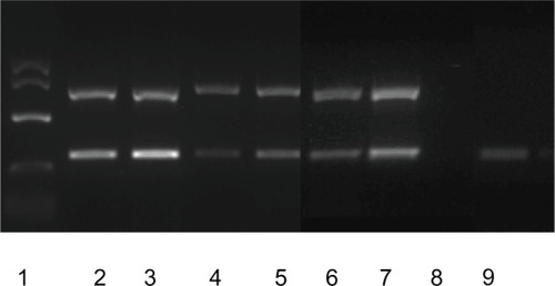 Figure 2 Expression of avian bornavirus (ABV) nucleoprotein and matrix protein genes in fecal and ureteral urine samples obtained from ABV-infected birds.