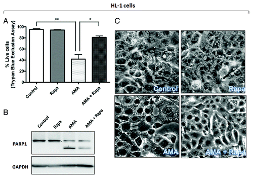 Figure 5A–C. Rapamycin protects against the cytotoxic effects of AMA in HL-1 and AC16 cardiomyocytes. (A and B) HL-1 cells were pre-treated with vehicle control or 1 µM rapamycin for 16 h, followed by incubation with 50 µM AMA for an additional 32 h, in the absence or presence of rapamycin. Cell viability was subsequently assessed using trypan blue exclusion assay (A) or cell lysates were collected and immunoblotted for PARP1 (B). GAPDH is used as a loading control. (C). HL-1 cells were pretreated with vehicle control or 1 µM rapamycin for 16 h, followed by incubation with 50 µM AMA for an additional 24 h, in the absence or presence of rapamycin. Phase contrast images of cells were subsequently taken. Representative images are shown.