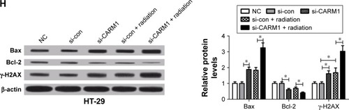 Figure 3 Effect of CARM1 knockdown on the radiosensitivity of CRC cells.