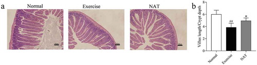 Figure 4. Effects of NAT on gut epithelial integrity in mice under intense exercise.(a) Histological photomicrograph of HE stained sections; (b) Villus length/Crypt depth ratio. Data are expressed as mean ± SEM (n  =  8). #p < 0.05, ##p < 0.01 (Exercise versus Normal), *p < 0.05, **p < 0.01 (NAT versus Exercise).
