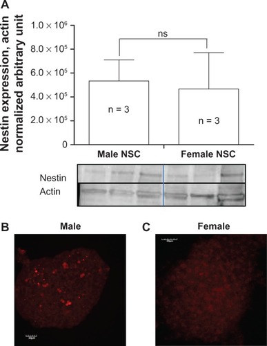 Figure 1 Nestin expression in undifferentiated NSCs. Quantification of nestin expression from three different rats of each gender. A) Positive nestin immunostaining in male B) and female C) NSCs cultured as neurospheres.