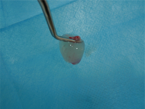 Figure S1 Platelet-rich plasma separated by standard two-step centrifugation protocol.