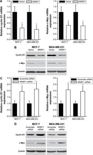 Figure 4 NRBP1 reduces downstream gene expression of Wnt/β-catenin signaling pathway in breast cancer.