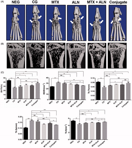 Figure 6. MTX–ALN prevented bone erosion and systemic bone loss in the CIA model. (A) Hind paws of rats were scanned with a high-resolution micro-CT. The most severe bone erosion was observed in the control group, while the least severe was shown in the MTX–ALN group. (B) Representative high-resolution micro-CT images of the distal tibia for each rat group. (C) Histomorphometric analysis of the distal tibia for the various treatment groups showing a significant increase in bone volume/tissue volume (BV/TV), bone surface/bone volume (BS/BV), trabecular thickness (Tb.Th.), trabecular separation (Tb.Sp.), and trabecular number (Tb.N.) in rats treated with MTX–ALN and ALN; MTX had no effect on histomorphometric parameters. ns, not significant. *p < .05, **p < .01, ***p < .005. NEG: negative control; CG: control; MTX + ALN: free MTX combined with free ALN.