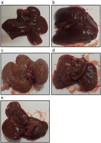 Figure 2. Effect of genistein at 25 and 75 mg/kg on liver images in in (a) the control group, (b) the control group treated with 75 mg/kg genistein, (c) the HCC group, (d) the HCC group treated with 25 mg/kg genistein and (e) the HCC treated with 75 mg/kg genistein.