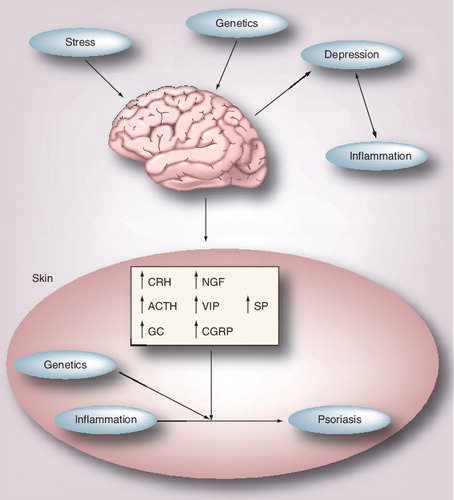Figure 1. Stress, genetics and the upregulation of neuropeptides in the skin contribute to the inflammatory response underlying psoriasis.Furthermore, psoriasis can be associated with a systemic inflammatory response Citation[25–28], which could exacerbate negative psychosocial states, resulting in high levels of anxiety and depression Citation[7–13].ACTH: Adrenocorticotropic hormone; CGRP: Calcitonin gene-related peptide; CRH: Corticotrophin-releasing hormone; GC: Glucocorticoid; NGF: Nerve growth factor; VIP: Vasoactive intestinal peptide.