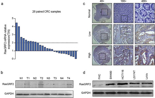 Figure 1. Increased expression of RasGRF2 in primary CRC tumors and CRC cell lines. (a) Real-time PCR and (b) western blot analysis of protein levels of RasGRF2 in primary tumors (T), matched adjacent nontumorous colorectal tissues (N). (c) Representative immunohistochemical staining results of RasGRF2 in tissues. (d) Western blot analysis of RasGRF2 expression in several CRC cell lines. GAPDH was used as the internal control for all analysis.