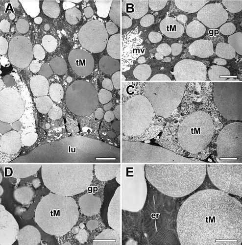 Figure 5. Electron micrographs of the major ampullate gland in A. cavaticus during the molting period. (A) Due to epithelial swelling, thickness of glandular epithelium is profoundly enlarged. (B) Cells are filled with Type-M secretory granules (tM), but Type-S granules are not observed. (C) Type-M secretory granules show a spherical appearance with low electron density commonly. (D, E) Precursors of the Type-M granules are produced as separated vesicles via well-oriented membranous cisternae of rER, but no Golgi complex has been found. gp: glycogen particles, lu: lumen, mv: microvilli. Scale bars indicate 1 µm (A), 0.2 µm (B-D), and 0.1 µm (E). respectively.