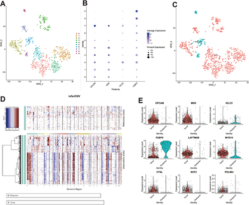 Figure 7 Epithelial cell analysis. (A) The t-distributed stochastic neighbor embedding (t-SNE) of 10 cell clusters. (B) Dot plot of different marker genes. (C) Identification of tumor and paratumor marker genes; (D) Copy number variation profile showing relative differences between the tumor and paratumor groups. (E) Violin plot of essential genes.
