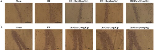 Figure 1. Chrysophanol alleviated the cerebral ischemia-reperfusion injury of hippocampus in mice. After 24 h of cerebral ischemia-reperfusion, the protective effects of Chry on hippocampus were assessed by hematoxylin and eosin staining. (A) H & E staining results for the histopathological of the CA1 region of the hippocampus indicated the histopathological changes in ischemia-reperfusion model as well as that caused by different concentrations of chrysophanol at a magnification of 200×. (B) H & E staining results for the histopathological of the dentate gyrus of the hippocampus indicated the histopathological changes in ischemia-reperfusion model as well as that caused by different concentrations of chrysophanol at a magnification of 200×.
