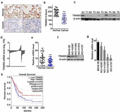 Figure 1. A. IHC experiments to compare protein level of TRIM55 in lung adenocarcinoma tissue and adjacent normal lung tissue. B. Histochemistry score analysis on TRIM55 level between lung adenocarcinoma samples and adjacent normal lung samples. C. Western-blot analysis on TRIM55 protein level between lung adenocarcinoma samples and matched normal tissues. D and E. TRIM55 mRNA expression level comparison between lung adenocarcinoma samples and adjacent normal lung samples. F. Western-blot analysis on TRIM55 protein expression in a normal human lung epithelial cell line (BEAS-2B) and lung adenocarcinoma cell lines (NCI-H2087, NCI-H1395, NCI-H1975, NCI-H157). G. qRT-PCR analysis on TRIM55 mRNA expression in a normal human lung epithelial cell line (BEAS-2B) and lung adenocarcinoma cell lines (NCI-H2087, NCI-H1395, NCI-H1975, NCI-H157). *** p < .001 compared with group BEAS-2B. H. Kaplan–Meier study on the overall survival comparison between the lung adenocarcinoma patient group with high/low TRIM55 expression levels.