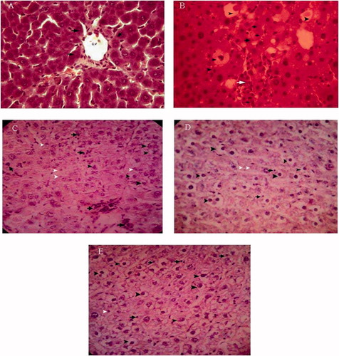 Figure 3.  Hepatic tissue sections. (A) Control rat, showing normal hepatocytes (arrow), central vein (C.V.). (B) CCl4-treated rat, showing severe fatty degeneration (arrow heads), cell necrosis (black arrows) and mononuclear inflammatory cell infiltration (white arrows). (C) Treatment group (0.05 mg/kg), (D) treatment group (0.2 mg/kg), and (E) treatment group (0.4 mg/kg) showing fatty degeneration (black arrow head), necrosis (white arrow head) and inflammation (arrow).