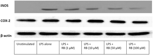 Figures 5. Effect of RB on LPS-induced iNOS and COX-2 expression in J774A.1 macrophages. Lysates were prepared from control or macrophages incubated for 24 h with LPS alone (1 μg/ml) or in combination with RB (1, 10, 50, or 100 μM). A representative Western blot is shown.