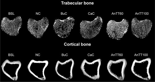 Figure 5 Three-dimensional µCT images of the trabecular and cortical microstructure of distal tibia metaphysis.